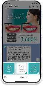 リッチメニュースマホの画像