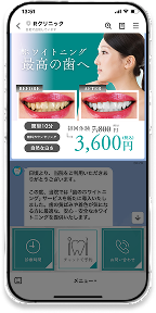 配信機能のスマホ画像